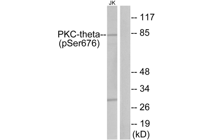 Western Blot - Anti-PKC thet (phospho Ser676) Antibody (A7197) - Antibodies.com
