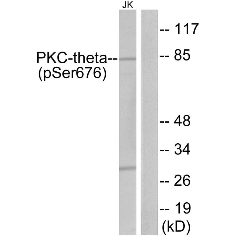 Western Blot - Anti-PKC thet (phospho Ser676) Antibody (A7197) - Antibodies.com