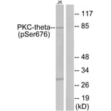 Western Blot - Anti-PKC thet (phospho Ser676) Antibody (A7197) - Antibodies.com