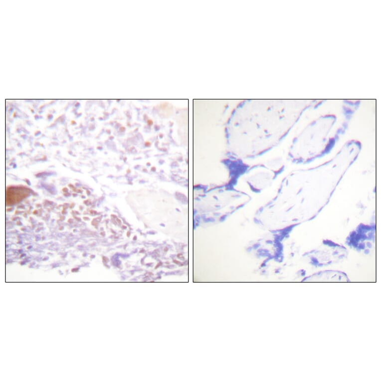 Immunohistochemistry - Anti-p57 Kip2 (phospho Thr310) Antibody (A0967) - Antibodies.com
