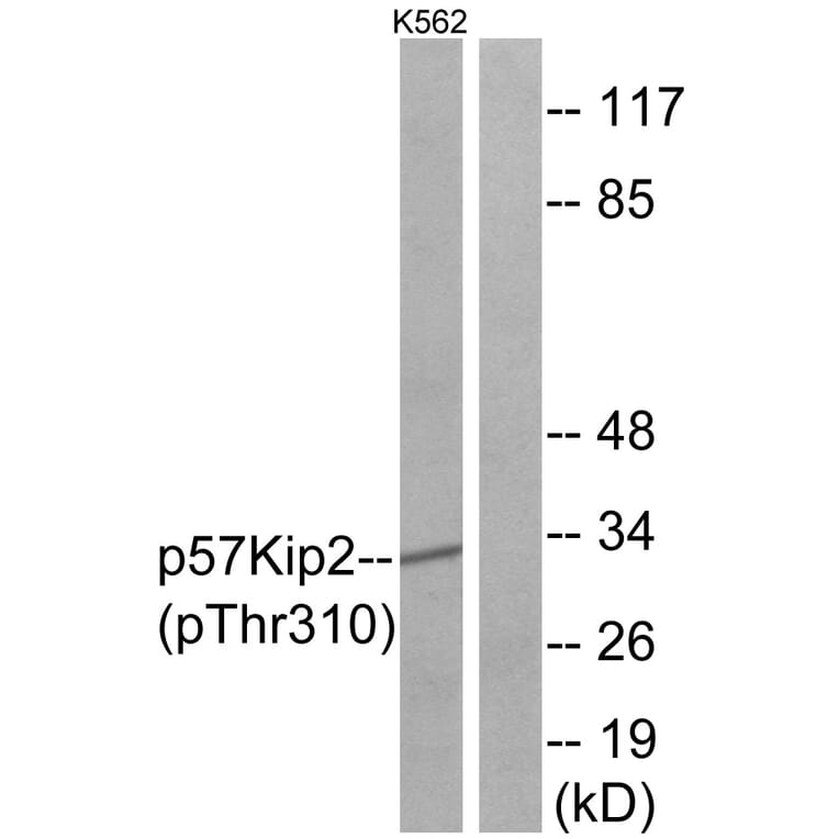 Western Blot - Anti-p57 Kip2 (phospho Thr310) Antibody (A0967) - Antibodies.com