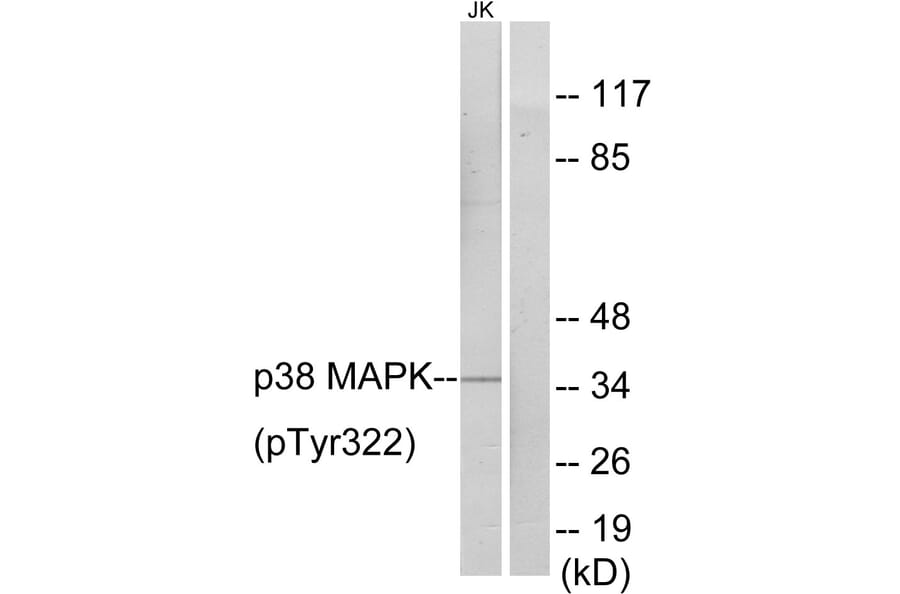 Western Blot - Anti-p38 MAPK (phospho Tyr322) Antibody (A0798) - Antibodies.com