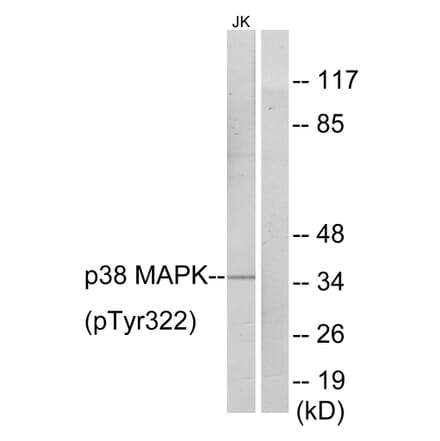 Western Blot - Anti-p38 MAPK (phospho Tyr322) Antibody (A0798) - Antibodies.com