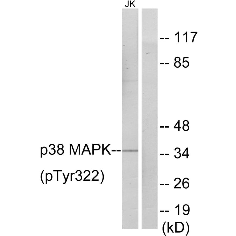 Western Blot - Anti-p38 MAPK (phospho Tyr322) Antibody (A0798) - Antibodies.com