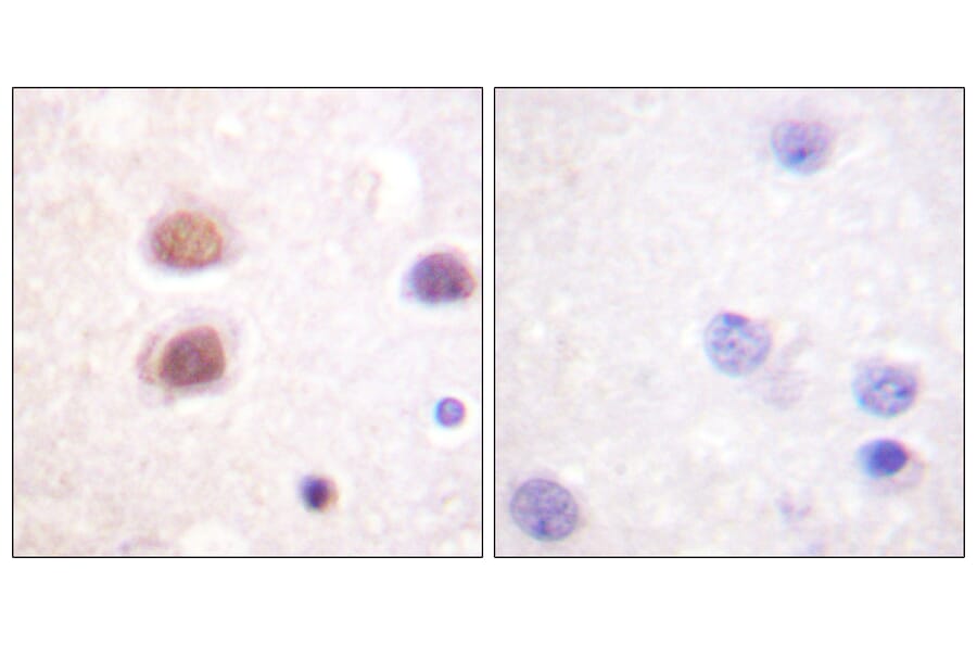 Immunohistochemistry - Anti-p38 MAPK (phospho Tyr322) Antibody (A0798) - Antibodies.com