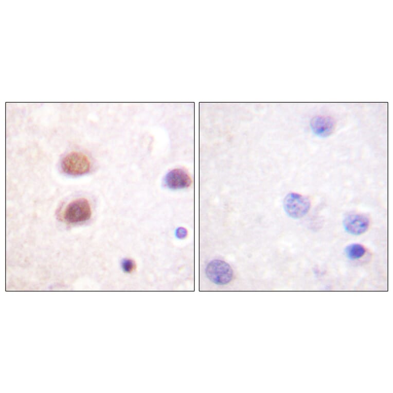 Immunohistochemistry - Anti-p38 MAPK (phospho Tyr322) Antibody (A0798) - Antibodies.com