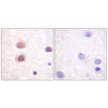 Immunohistochemistry - Anti-p38 MAPK (phospho Tyr322) Antibody (A0798) - Antibodies.com