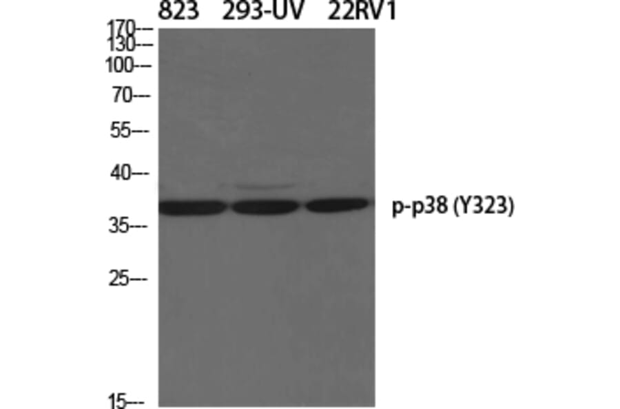 Western Blot - Anti-p38 MAPK (phospho Tyr322) Antibody (A0798) - Antibodies.com