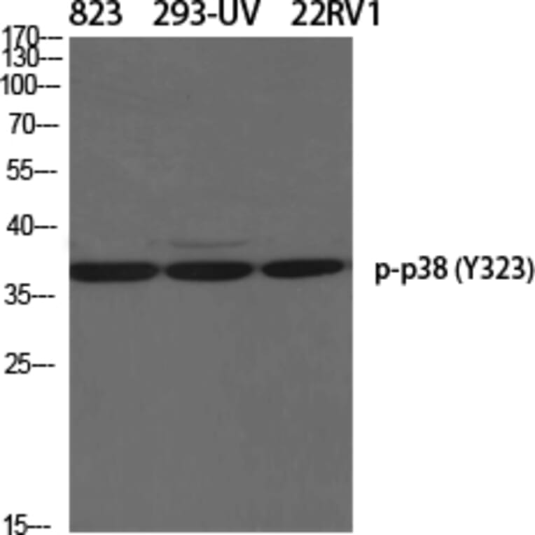 Western Blot - Anti-p38 MAPK (phospho Tyr322) Antibody (A0798) - Antibodies.com