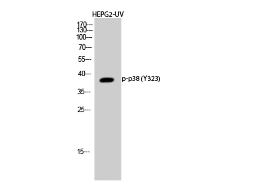 Western Blot - Anti-p38 MAPK (phospho Tyr322) Antibody (A0798) - Antibodies.com