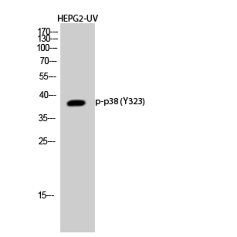 Western Blot - Anti-p38 MAPK (phospho Tyr322) Antibody (A0798) - Antibodies.com