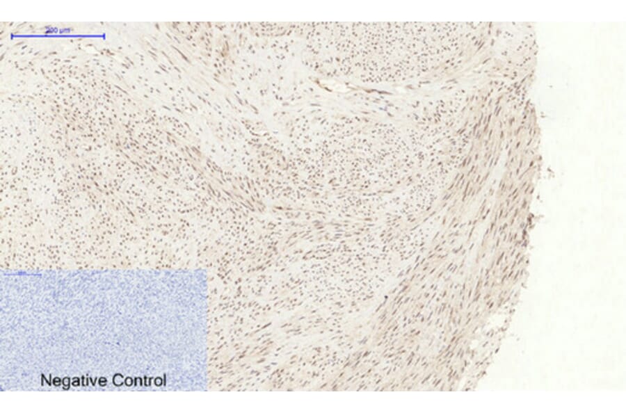 Immunohistochemistry - Anti-p38 MAPK (phospho Tyr322) Antibody (A0798) - Antibodies.com