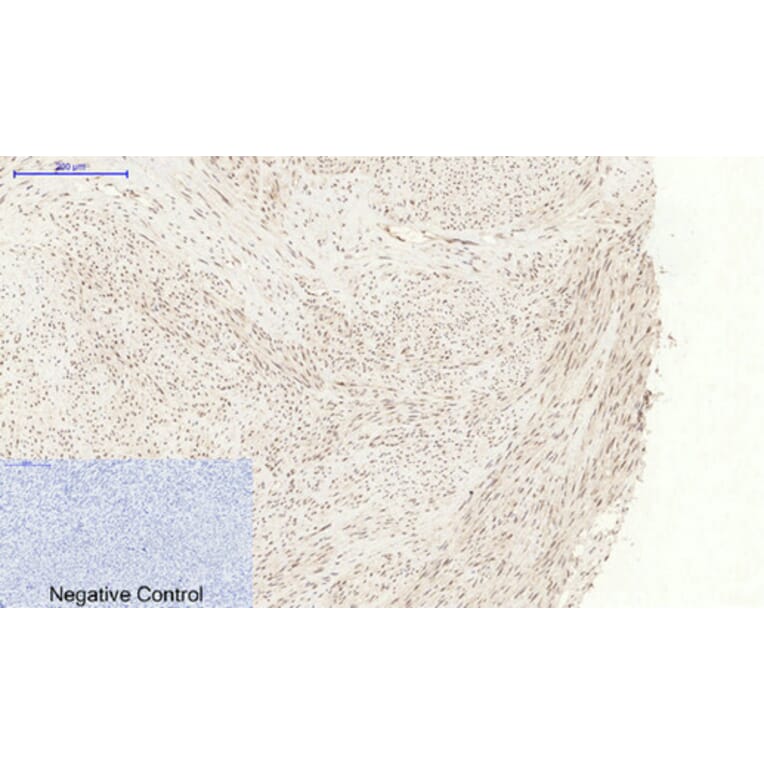 Immunohistochemistry - Anti-p38 MAPK (phospho Tyr322) Antibody (A0798) - Antibodies.com