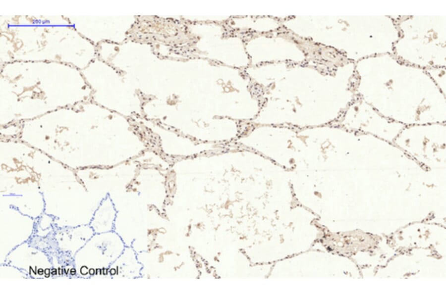 Immunohistochemistry - Anti-p38 MAPK (phospho Tyr322) Antibody (A0798) - Antibodies.com