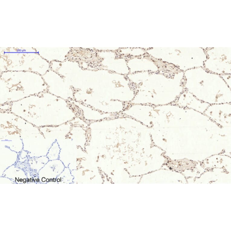 Immunohistochemistry - Anti-p38 MAPK (phospho Tyr322) Antibody (A0798) - Antibodies.com
