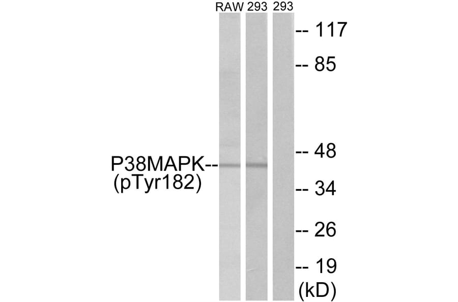 Western Blot - Anti-p38 MAPK (phospho Tyr182) Antibody (A7179) - Antibodies.com