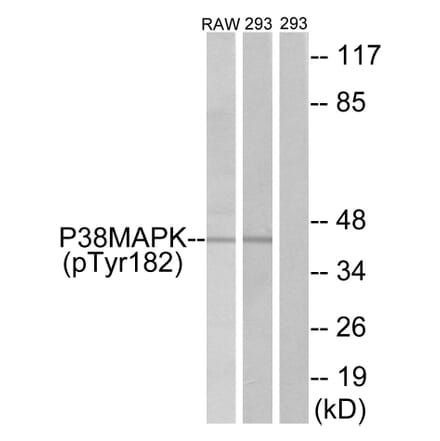 Western Blot - Anti-p38 MAPK (phospho Tyr182) Antibody (A7179) - Antibodies.com