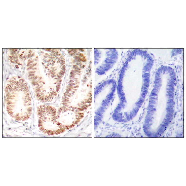 Immunohistochemistry - Anti-p38 MAPK (phospho Tyr182) Antibody (A7179) - Antibodies.com