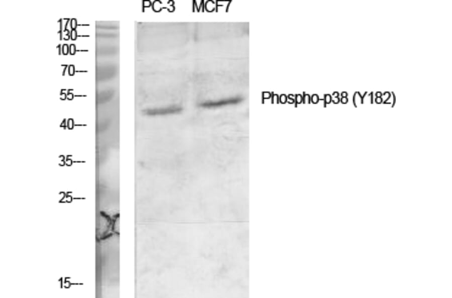 Western Blot - Anti-p38 MAPK (phospho Tyr182) Antibody (A7179) - Antibodies.com