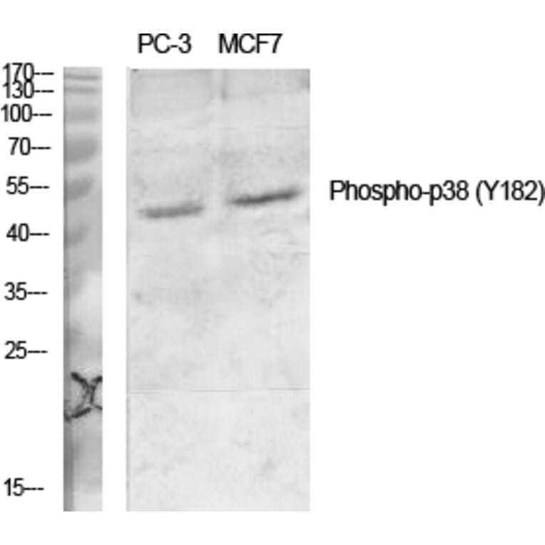 Western Blot - Anti-p38 MAPK (phospho Tyr182) Antibody (A7179) - Antibodies.com