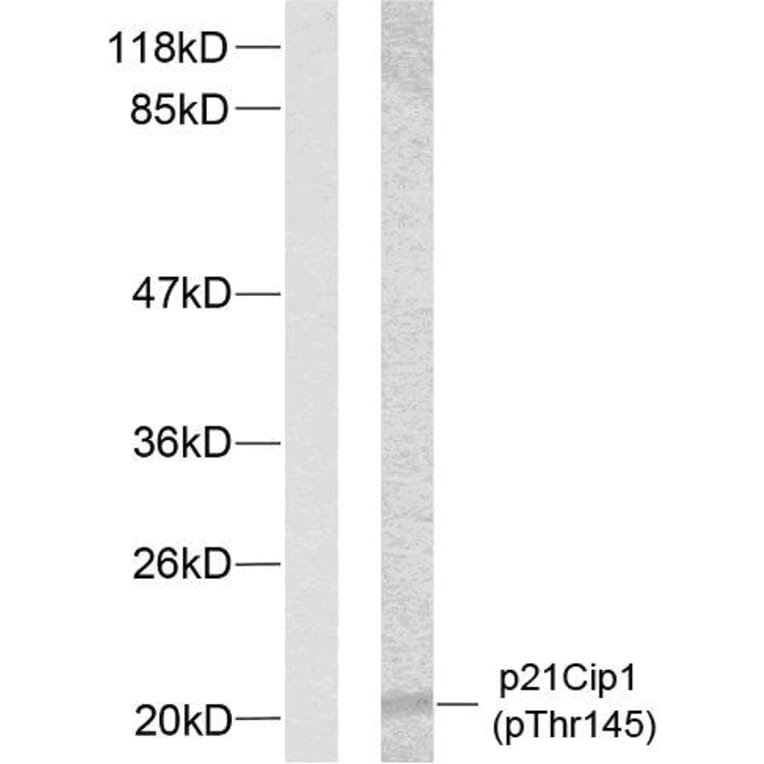 Western Blot - Anti-p21 Cip1 (phospho Thr145) Antibody (A7175) - Antibodies.com