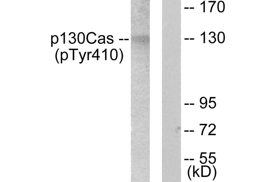 Western Blot - Anti-p130 Cas (phospho Tyr410) Antibody (A0077) - Antibodies.com