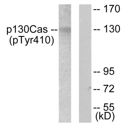 Western Blot - Anti-p130 Cas (phospho Tyr410) Antibody (A0077) - Antibodies.com