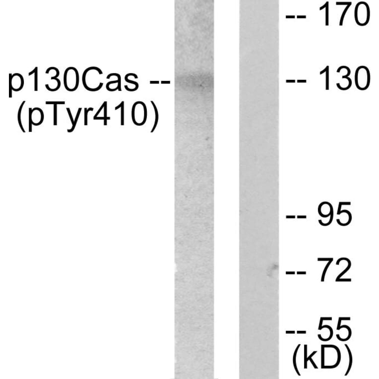 Western Blot - Anti-p130 Cas (phospho Tyr410) Antibody (A0077) - Antibodies.com