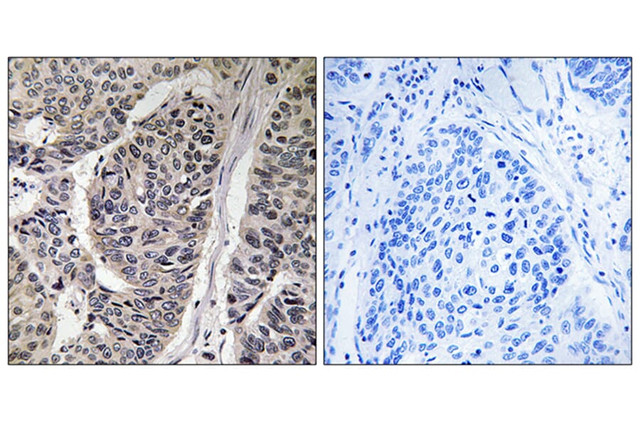 Immunohistochemistry - Anti-p130 Cas (phospho Tyr410) Antibody (A0077) - Antibodies.com
