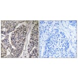Immunohistochemistry - Anti-p130 Cas (phospho Tyr410) Antibody (A0077) - Antibodies.com