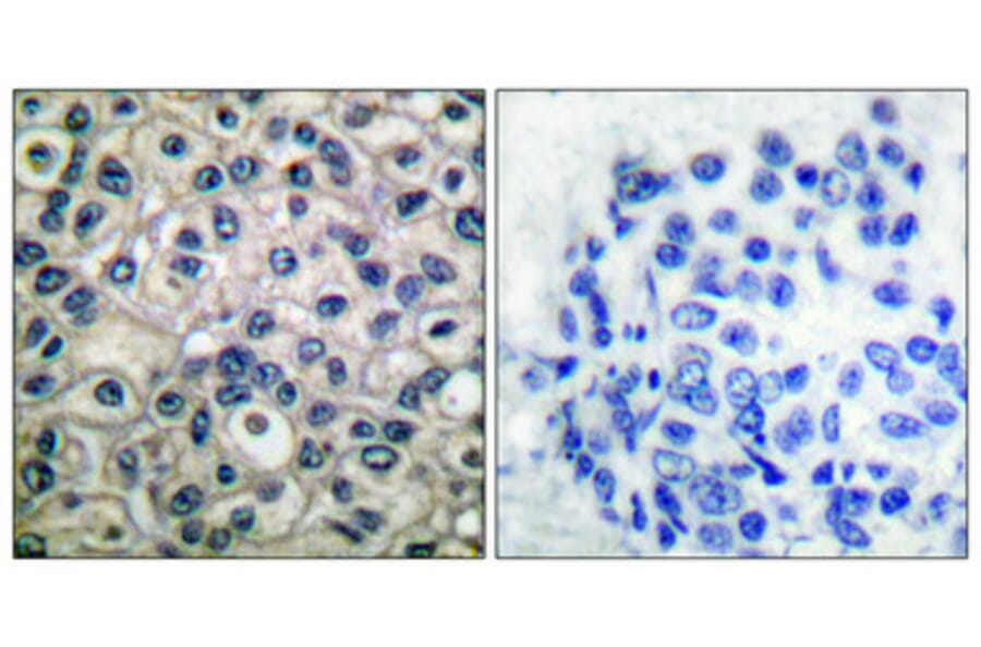 Immunohistochemistry - Anti-p130 Cas (phospho Tyr410) Antibody (A0077) - Antibodies.com