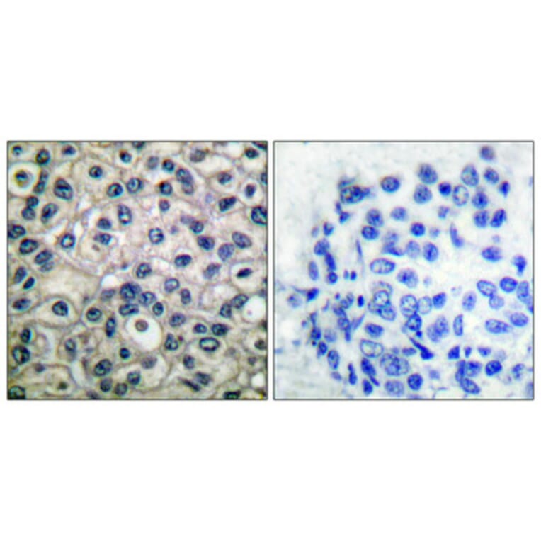 Immunohistochemistry - Anti-p130 Cas (phospho Tyr410) Antibody (A0077) - Antibodies.com