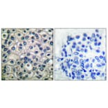 Immunohistochemistry - Anti-p130 Cas (phospho Tyr410) Antibody (A0077) - Antibodies.com