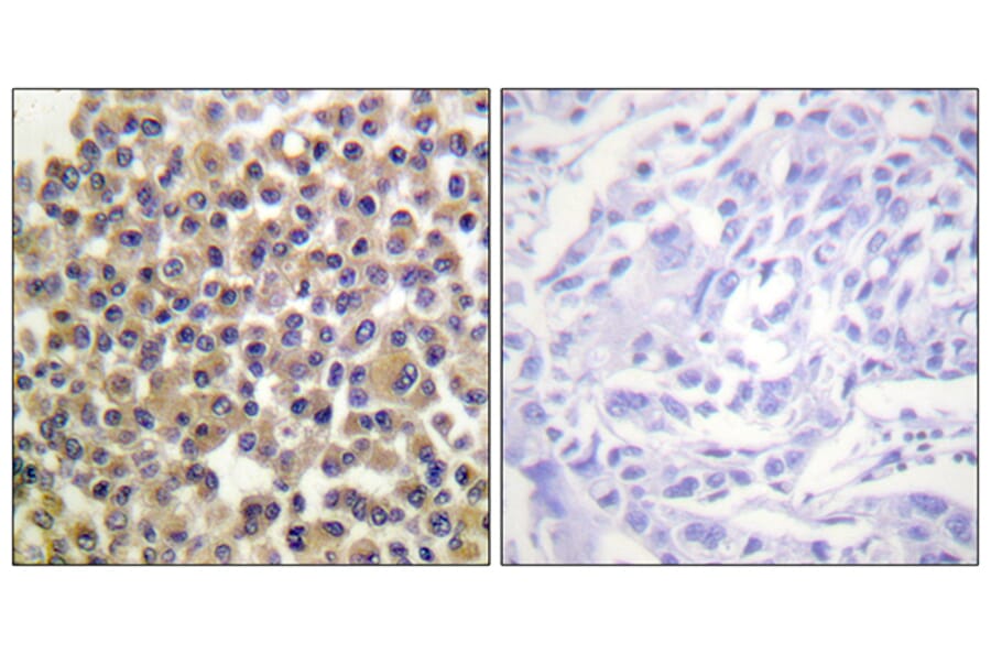 Immunohistochemistry - Anti-p130 Cas (phospho Tyr249) Antibody (A0696) - Antibodies.com