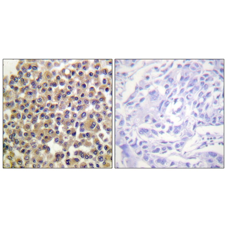 Immunohistochemistry - Anti-p130 Cas (phospho Tyr249) Antibody (A0696) - Antibodies.com