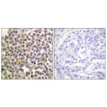 Immunohistochemistry - Anti-p130 Cas (phospho Tyr249) Antibody (A0696) - Antibodies.com