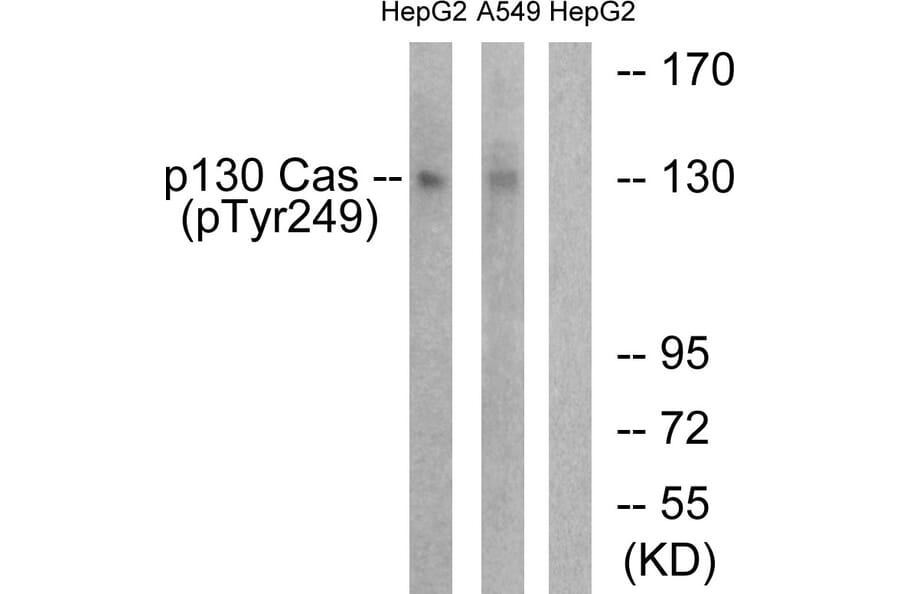 Western Blot - Anti-p130 Cas (phospho Tyr249) Antibody (A0696) - Antibodies.com