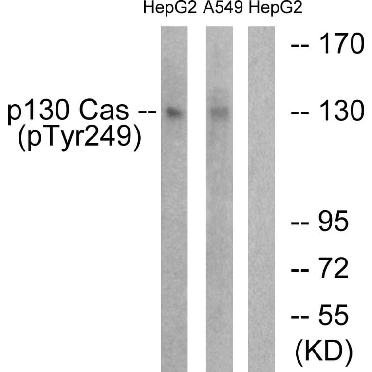 Western Blot - Anti-p130 Cas (phospho Tyr249) Antibody (A0696) - Antibodies.com