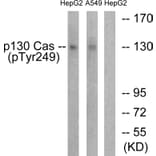 Western Blot - Anti-p130 Cas (phospho Tyr249) Antibody (A0696) - Antibodies.com