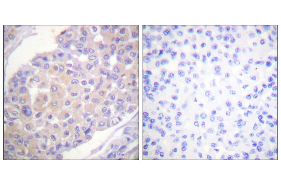 Immunohistochemistry - Anti-p130 Cas (phospho Tyr165) Antibody (A0695) - Antibodies.com