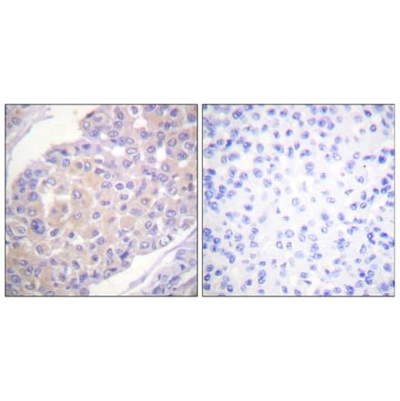 Immunohistochemistry - Anti-p130 Cas (phospho Tyr165) Antibody (A0695) - Antibodies.com