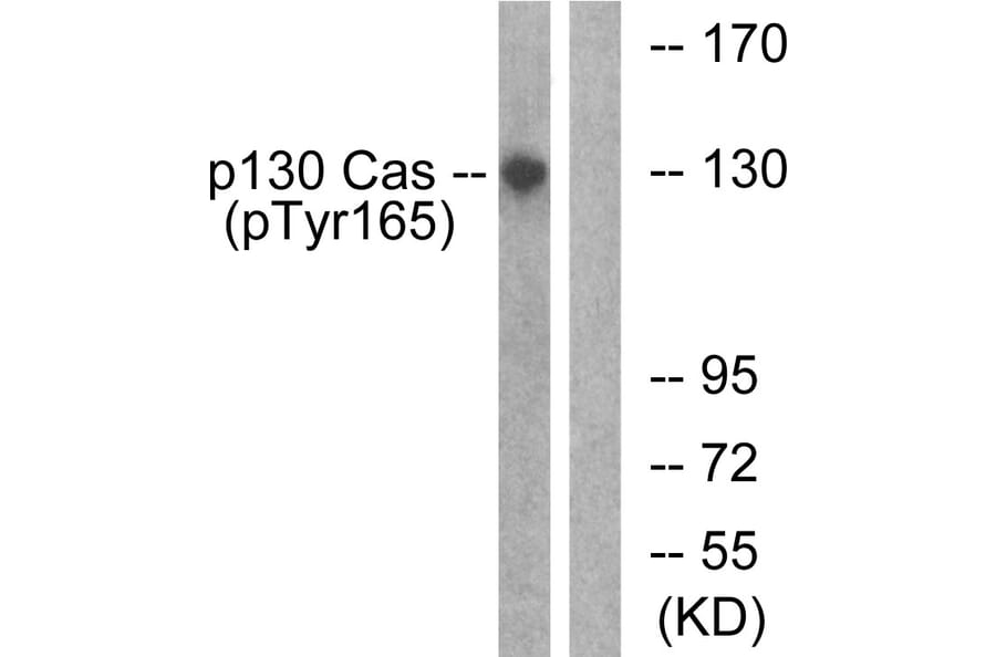 Western Blot - Anti-p130 Cas (phospho Tyr165) Antibody (A0695) - Antibodies.com