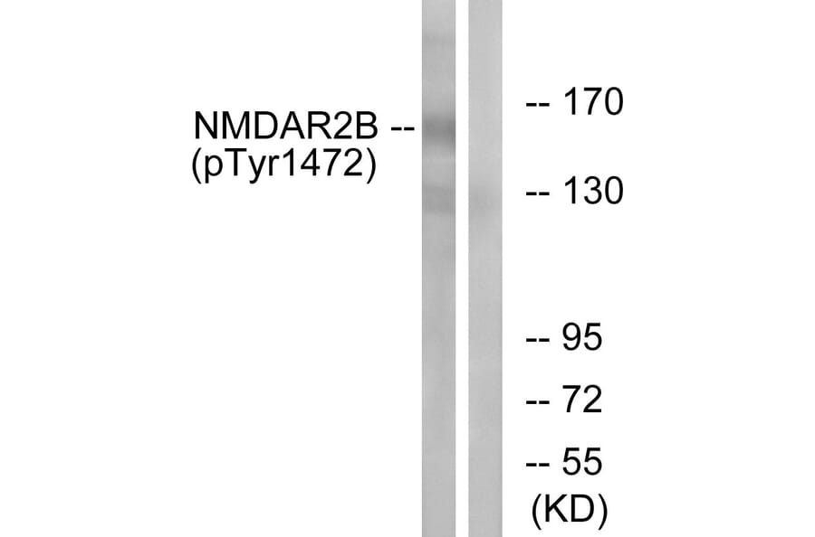 Western Blot - Anti-NMDAR2B (phospho Tyr1474) Antibody (A0526) - Antibodies.com