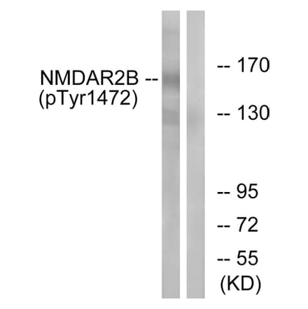 Western Blot - Anti-NMDAR2B (phospho Tyr1474) Antibody (A0526) - Antibodies.com