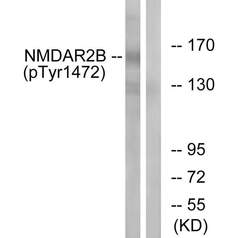 Western Blot - Anti-NMDAR2B (phospho Tyr1474) Antibody (A0526) - Antibodies.com