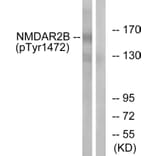 Western Blot - Anti-NMDAR2B (phospho Tyr1474) Antibody (A0526) - Antibodies.com