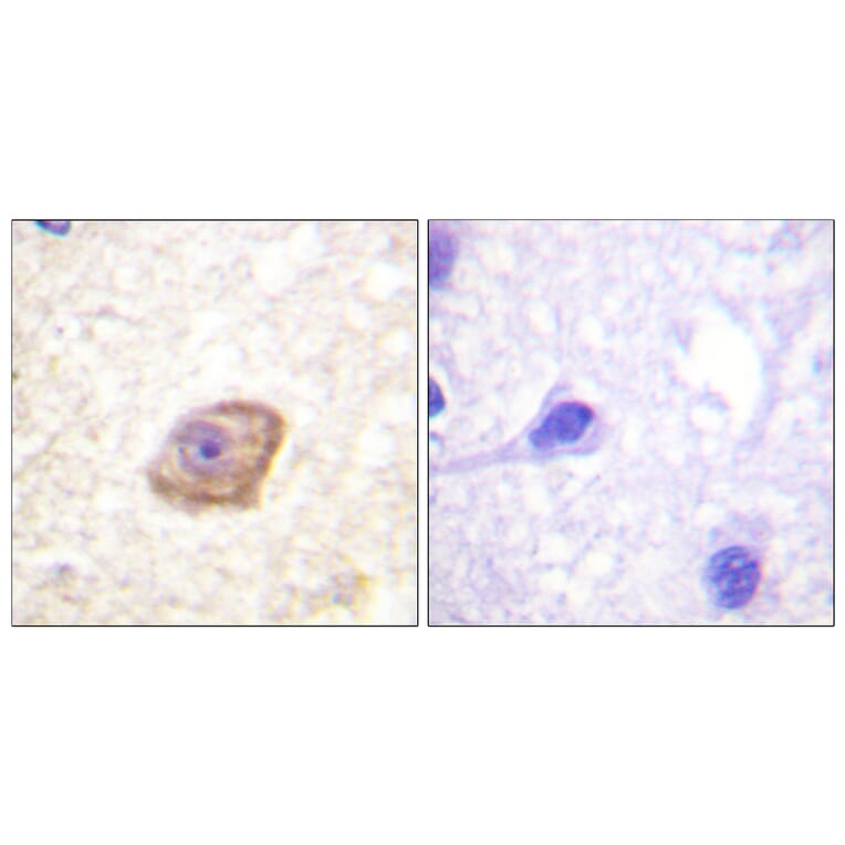 Immunohistochemistry - Anti-NMDAR2B (phospho Tyr1474) Antibody (A0526) - Antibodies.com