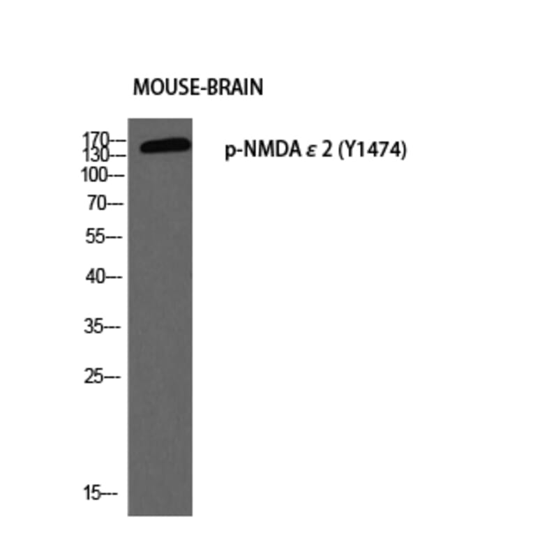 Western Blot - Anti-NMDAR2B (phospho Tyr1474) Antibody (A0526) - Antibodies.com