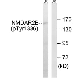 Western Blot - Anti-NMDAR2B (phospho Tyr1336) Antibody (A8257) - Antibodies.com