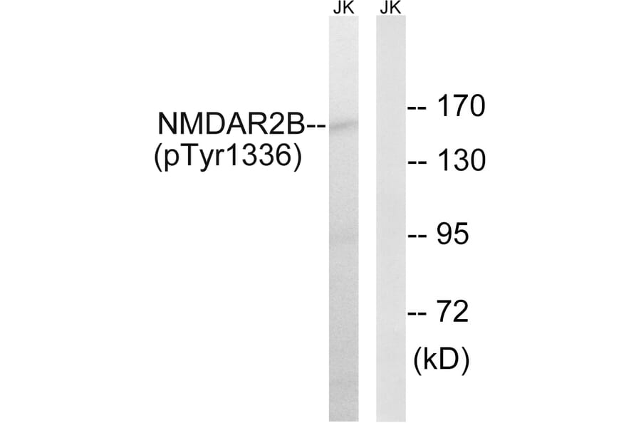 Western Blot - Anti-NMDAR2B (phospho Tyr1336) Antibody (A8257) - Antibodies.com